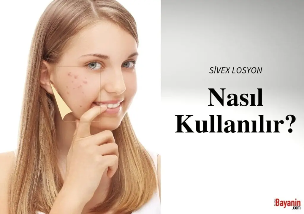 Sivex Losyon Kullanımı