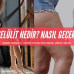 Selülit Nedir? Nasıl Gider?