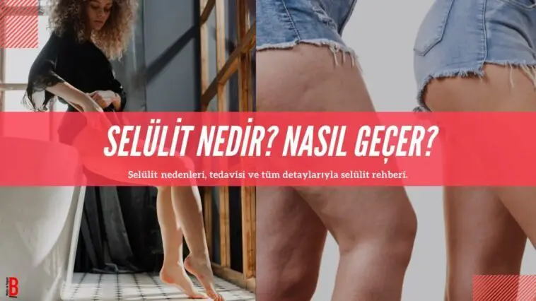 Selülit Nedir? Nasıl Gider?